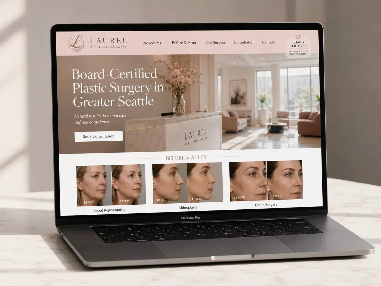 MacBook screen showing example web design for plastic surgery, with before and after gallery preview, Book Consultation CTA, and surgeon credentials section, built by ChegTech